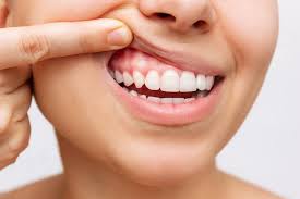 Gum Health